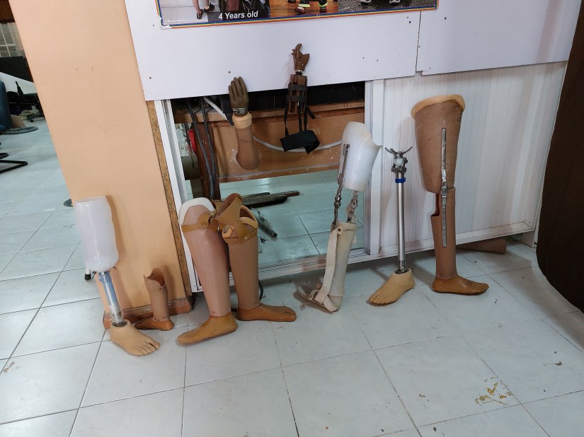 Different types of prostheses